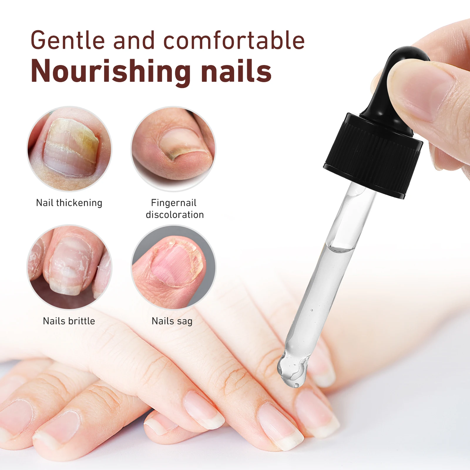 Solução de reparo de unhas para reparos de unhas dos pés, descoloração de unhas rachadas, aumenta a espessura, hidrata o tratamento