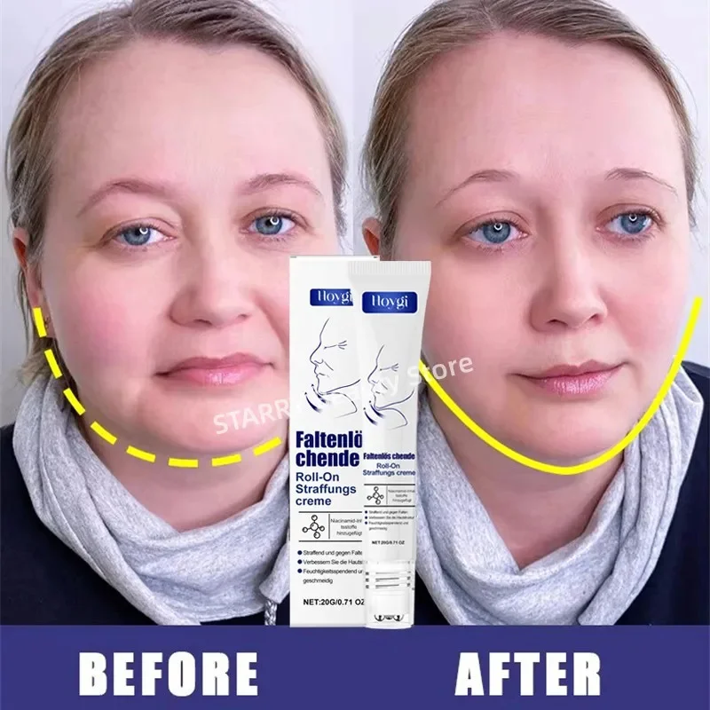 

V-Shape Face Slimming Cream Remove Double Chins Firming Lifting Up V Cheek Fat Burning Anti-aging Shaping Massage Care Products