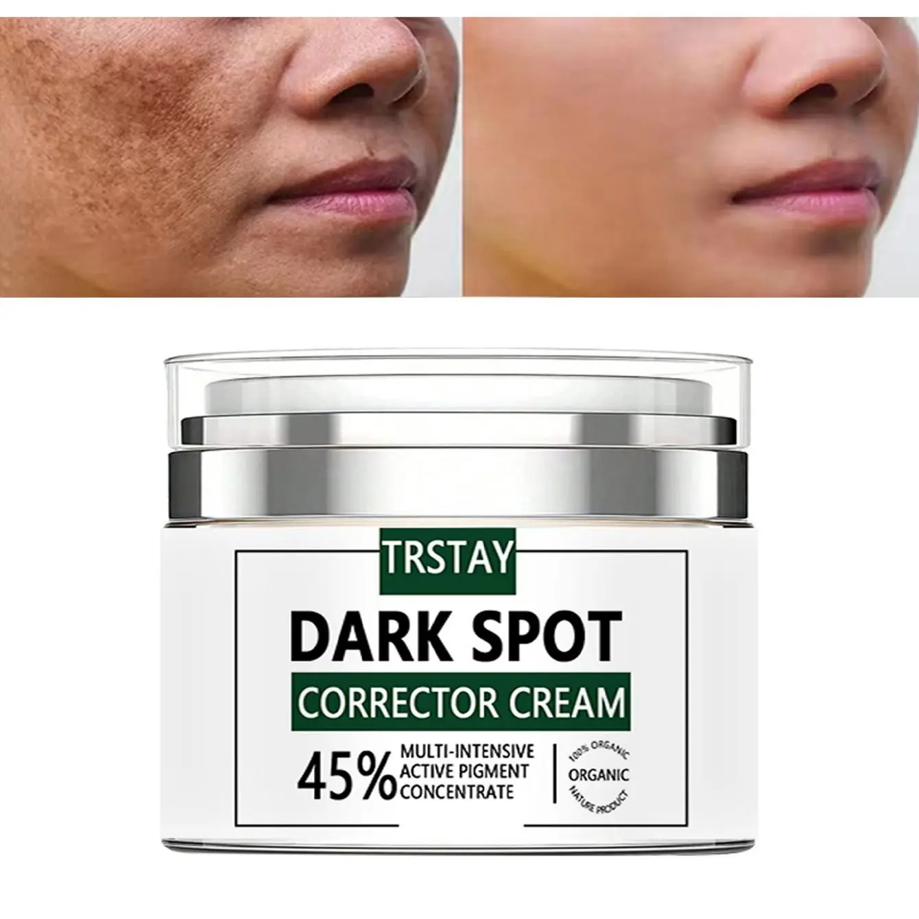 Spot Removal Cream, Lightens And Repairs Aging Skin, Providing Long-Lasting Nourishment And Moisturizing