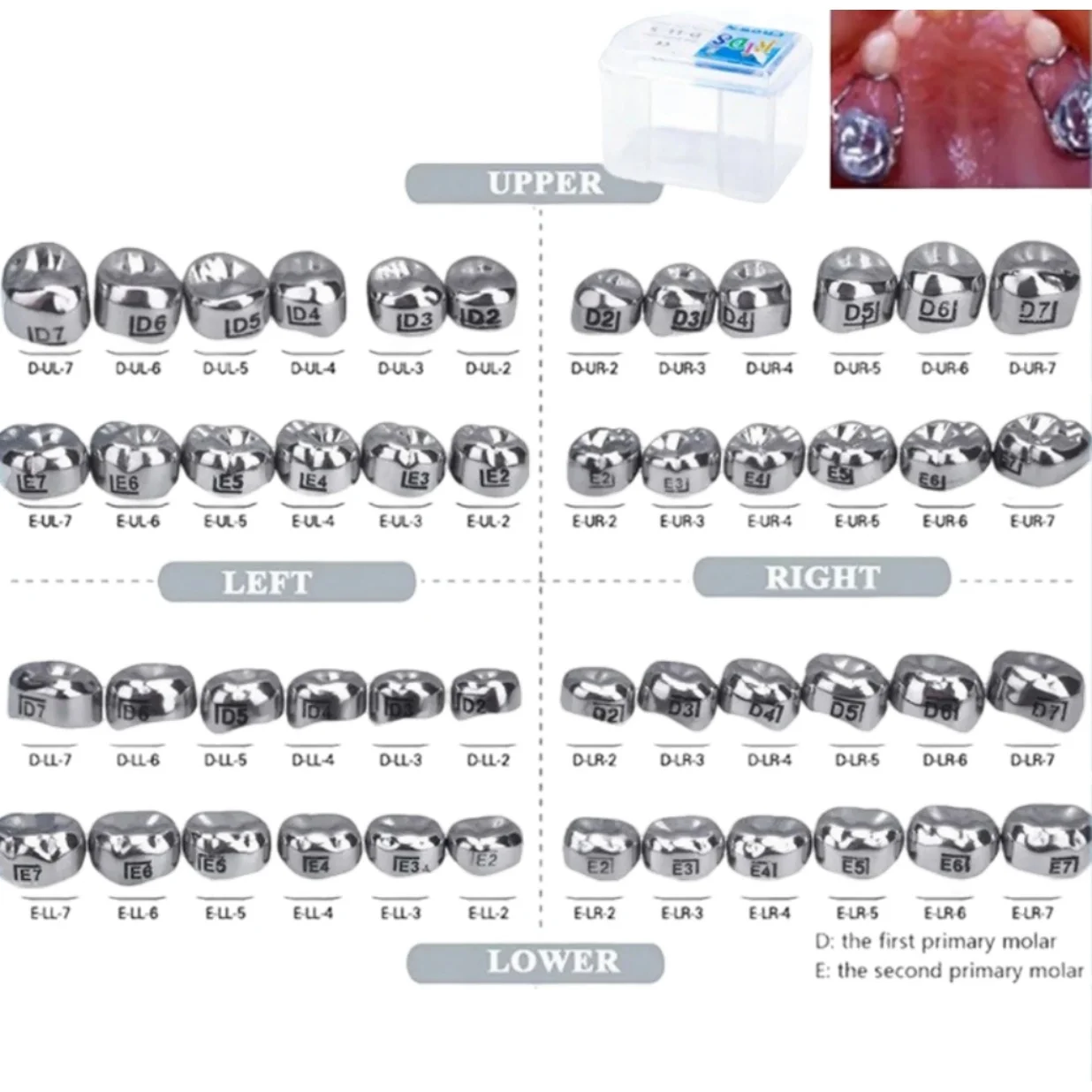 

5Pcs/Box Dental Crown kids Primary Molar Upper Left 1st/2nd Stainless Steel Metal Crowns D2-D7 For Adult/Child Dentist Materials