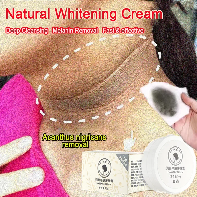 

70g Fast Whitening Cream Dark Neck Feet Underarm Elbows Melanin Remove Armpit Knees Bleach Black Spots Lighten Private Skin Care