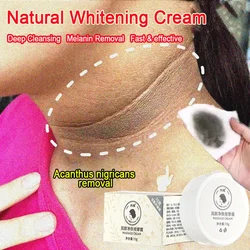 Fast Whitening Cream Dark Neck Feet Underarm Elbows Melanin Remove Armpit Knees Bleach Black Spots Lighten Private Skin Care 70