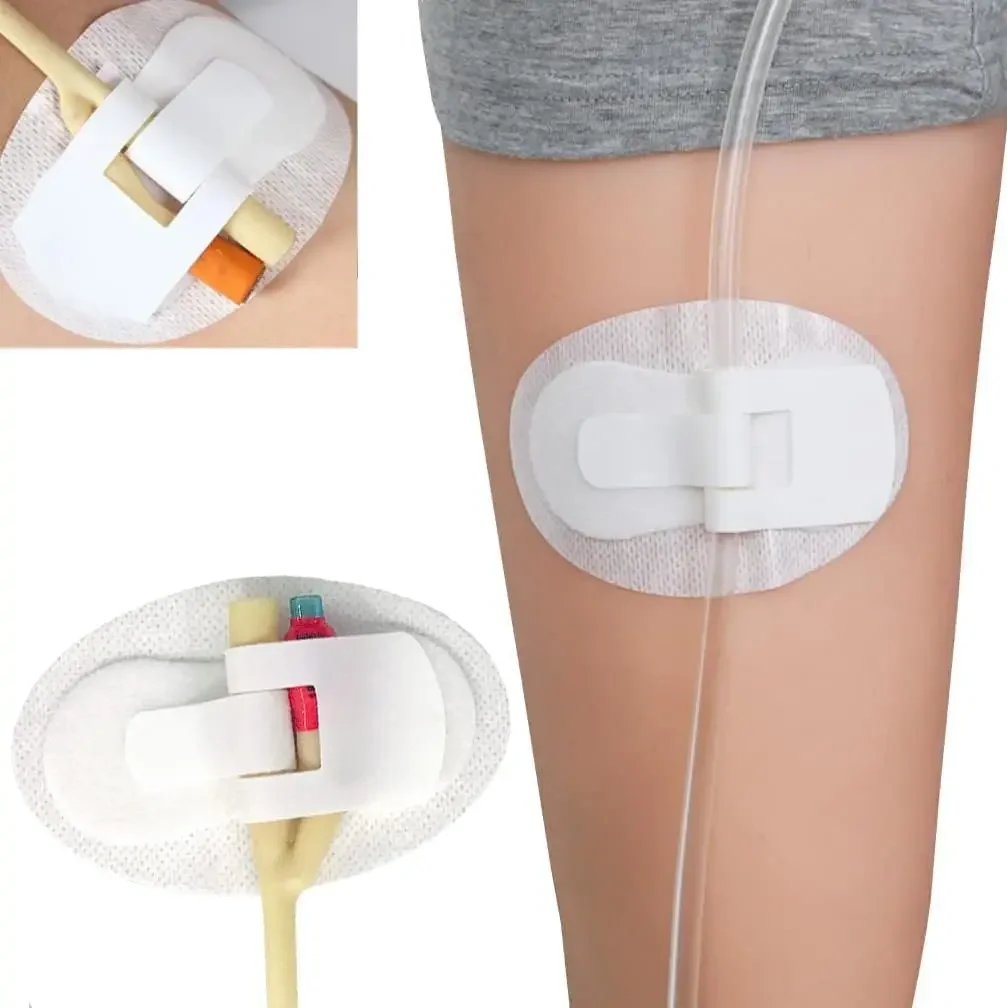 Dispositivo di stabilizzazione del catetere Catetere Borsa per gamba urinaria Supporto per fascia per gamba Adesivo per supporto per fascia per gamba (confezione da 10)