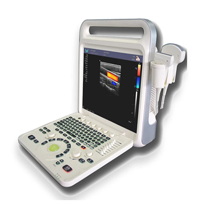 Wholesale E60 Full Digital Color Doppler System Suppliers Therapeutic Portable Ultrasound Equipment