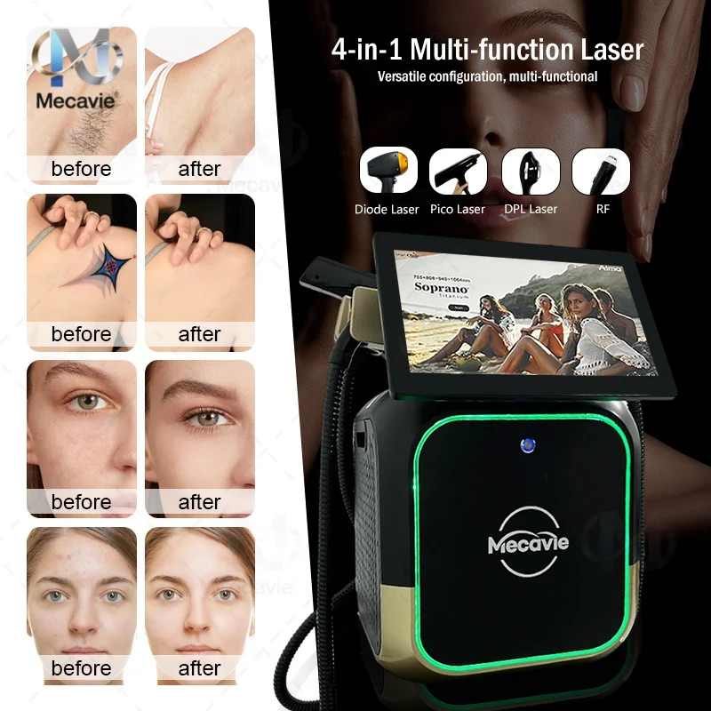 

4 IN 1 4000w Soprano Titanium Ice Platinum Diode 4 Wavelength Laser ND:YAG RF IPL OPT Machine Painless Hair Removal Machine 2026