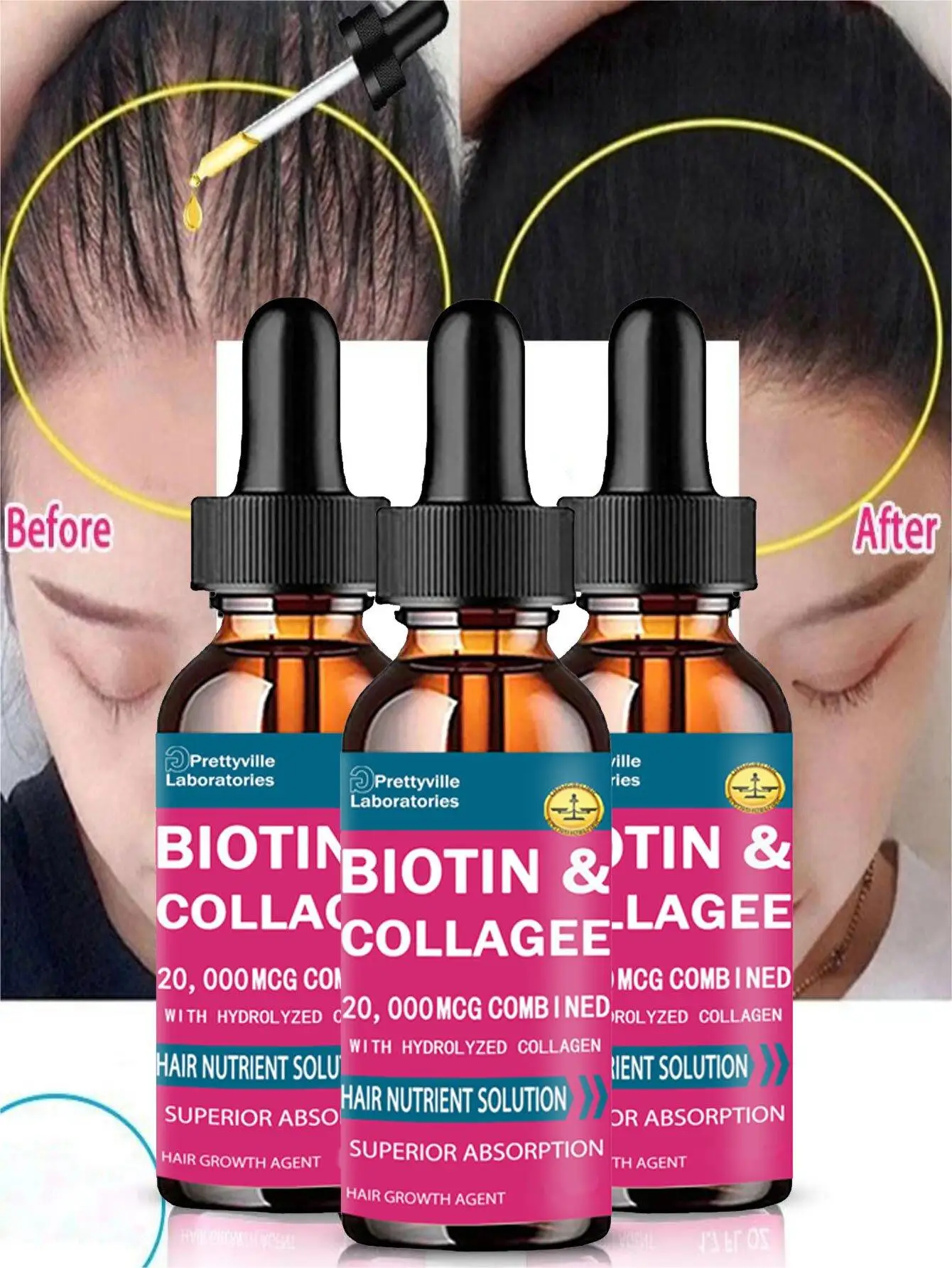 Hairloss Hair Alopecia Hair Treatment for Black Women Growth Oil Head Care Growth Spray