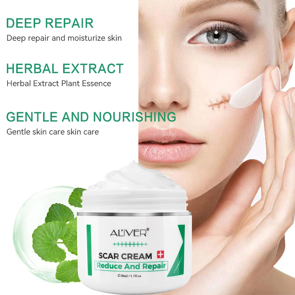 ALVER Acne Scar Stretch Marks Remover Cream Skin Repair Acne Black Dots Spots Acne Treatment Blackhead Bleaching Cream 50ml