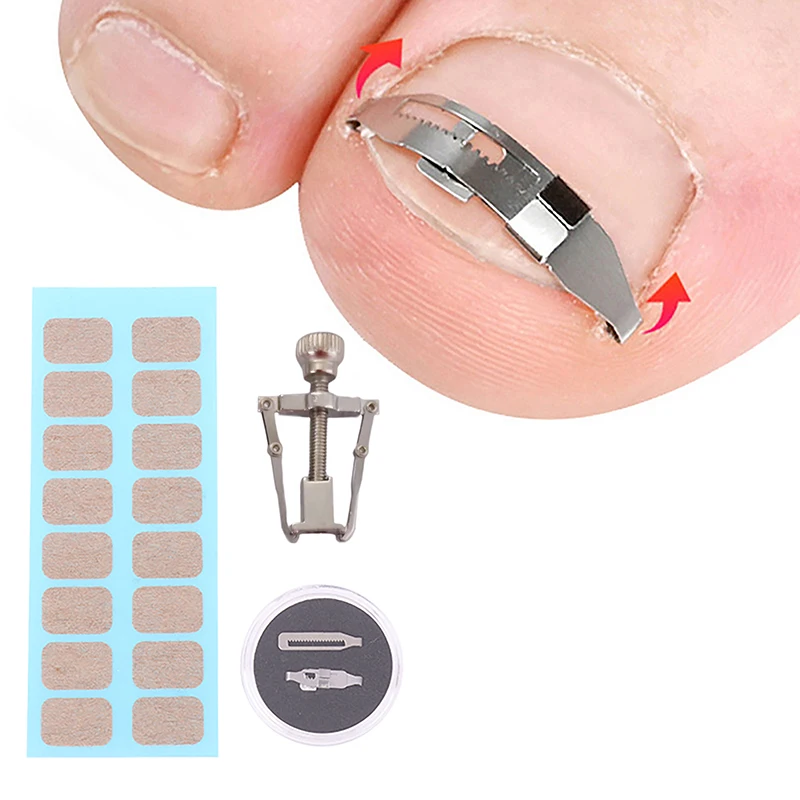 Ferramentas corretoras de unhas encravadas, regulador de tratamento de unhas encravadas, remendo fixo, pedicure, recuperação profissional, cuidados com os pés