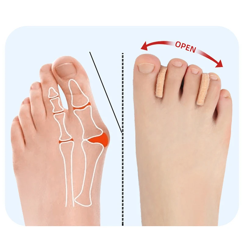 Felt Toe Straightener, Polegar sobreposição Toe Separator, Divisor diário Toe, grande cuidado do osso do pé, cuidados com os pés, 10pcs