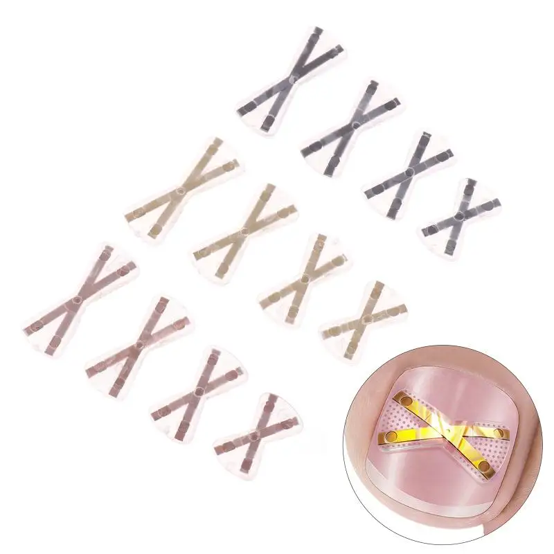 X-shaped Ingrown Toenail Correction Tool Ingrown Toenail Treatments Elastic Patch Sticker Toenail Straightening Pedicure Tool