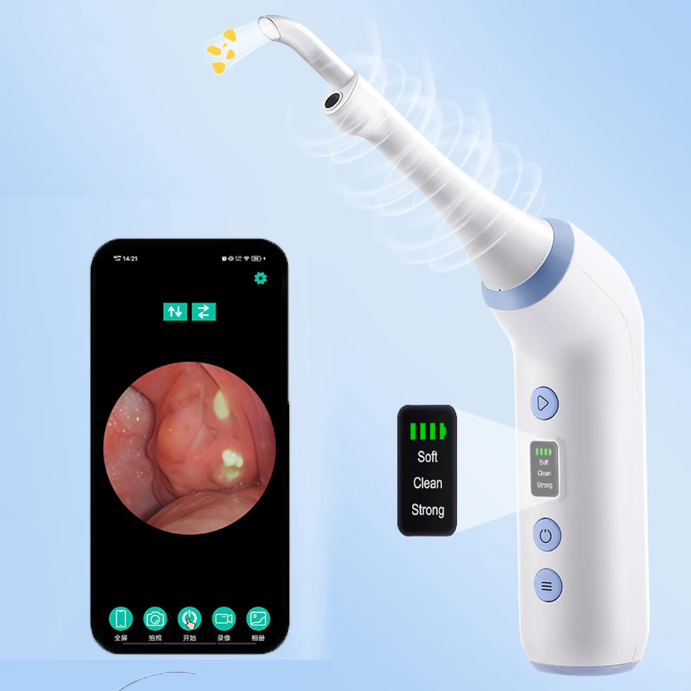 

Vacuum Tonsil Stone Remover Kit with 3 Suction Modes Oral Care Tool for Tonsil Stones Removal Oral Fresh Care