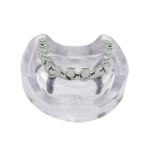 Imagen 2 del producto Modelo Dental, modelo de restauración de implantes, modelo de sobredentadura removible maxilar con 4 implantes, modelo educativo para estudiantes de dentista