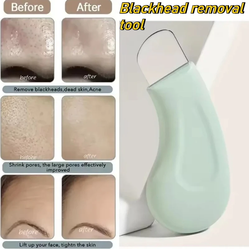 

1/2PCS Manual Blackhead Remover Stainless Steel Facial Pore Cleaning Scraper Tool for Acne Comedone Nose Care Beauty Accessories