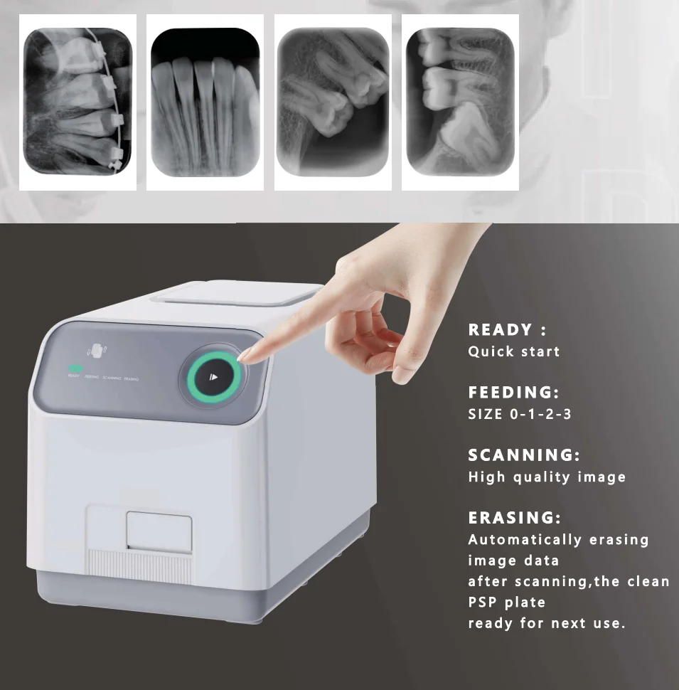 High Resolution Dental X Ray PSP Plate Scanner Phosphor Plate Scanner 17 Lp/Mm, 30μM, Dicom with 1 Image Plate Support TWAIN