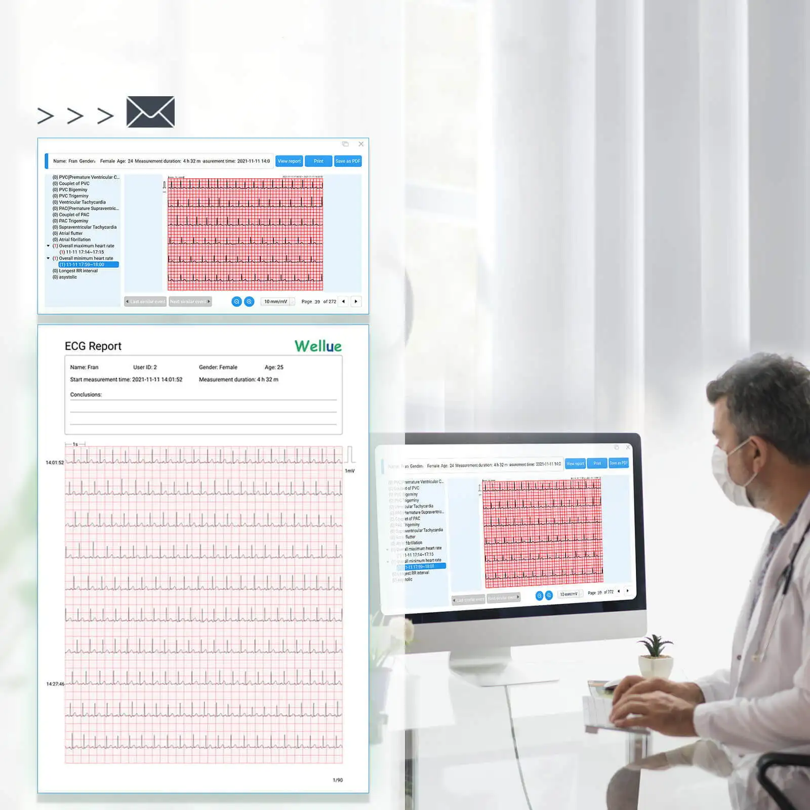 AI analysis ECG 24 hours monitoring Wearable ECG Bluetooth heart rate monitoring Single lead ECG usage time 72 hours