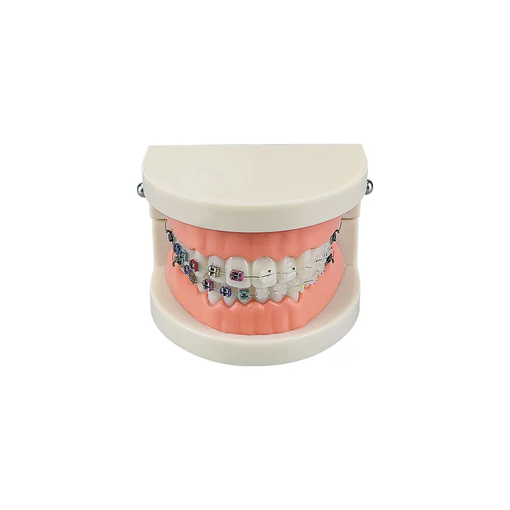 Dental Orthodontic Treatment Model With Ortho Metal Ceramic Bracket Arch Wire Buccal Tube Ligature Ties Dental Tools Teeth Model