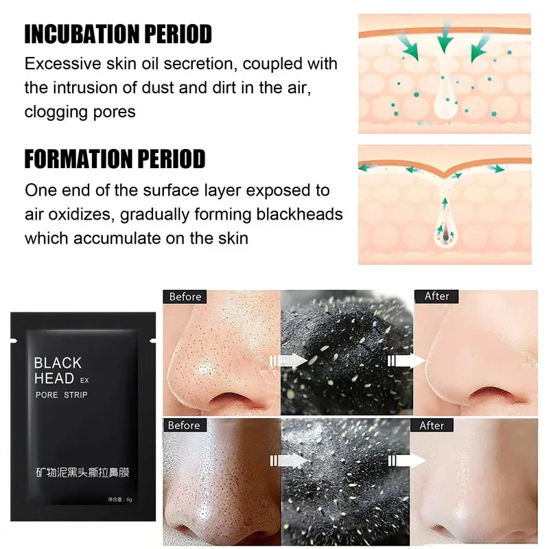 10pc Blackhead Removal Mask Oil-Control Shrink Pores Acne Treatment Nose Cleansing Facial Skin Care Black Head Peel Off Mask Gel