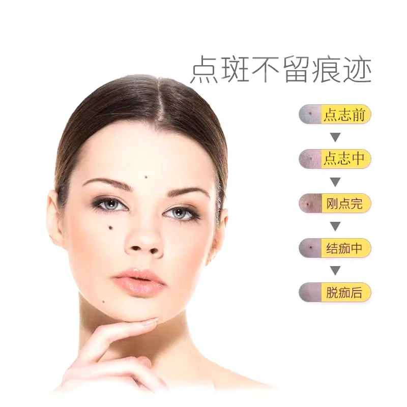 Stylo spécial pour salon de beauté, enlève les grains de beauté et les taches de rousseur, livraison gratuite