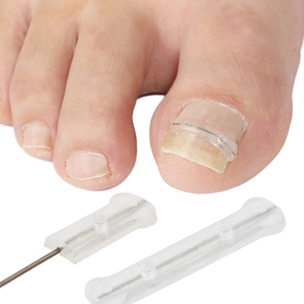 Titanium Alloy Silicone Toenail Corrector Ingrown Nail Repair Tool Stretchable Wear-Resistant Daily Use Foot Care Tool