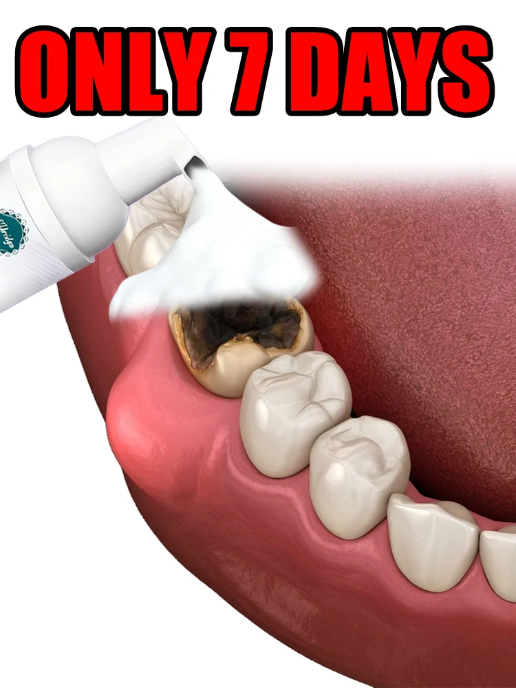 

Инструменты для ухода за зубами, пенка для полости рта, гарантия качества, гарантия оригинального продукта, портативная и легкая.