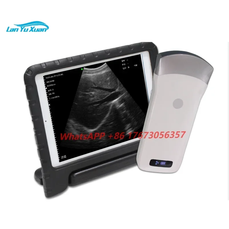 Medical B Type Doppler Ultrasound Scanner Wifi Wireless Probe Convex Portable Ultrasonic Machine