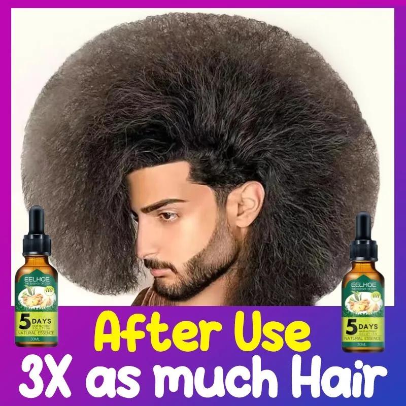 Óleo essencial de gengibre para o crescimento do cabelo, essência anti-perda, reparação do couro cabeludo, danos, crescer, nutriir, couro cabeludo,