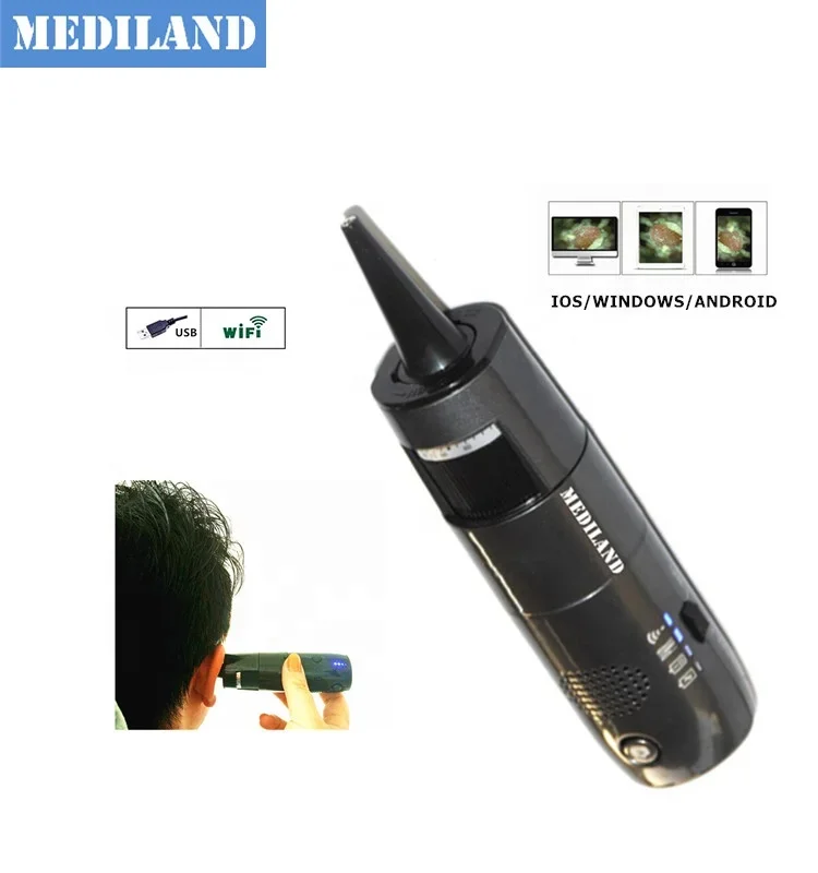 ML-OTN1 Otoscope set digital wifi microscope with USB mode HD video household wireless Endoscope to check ear and nose