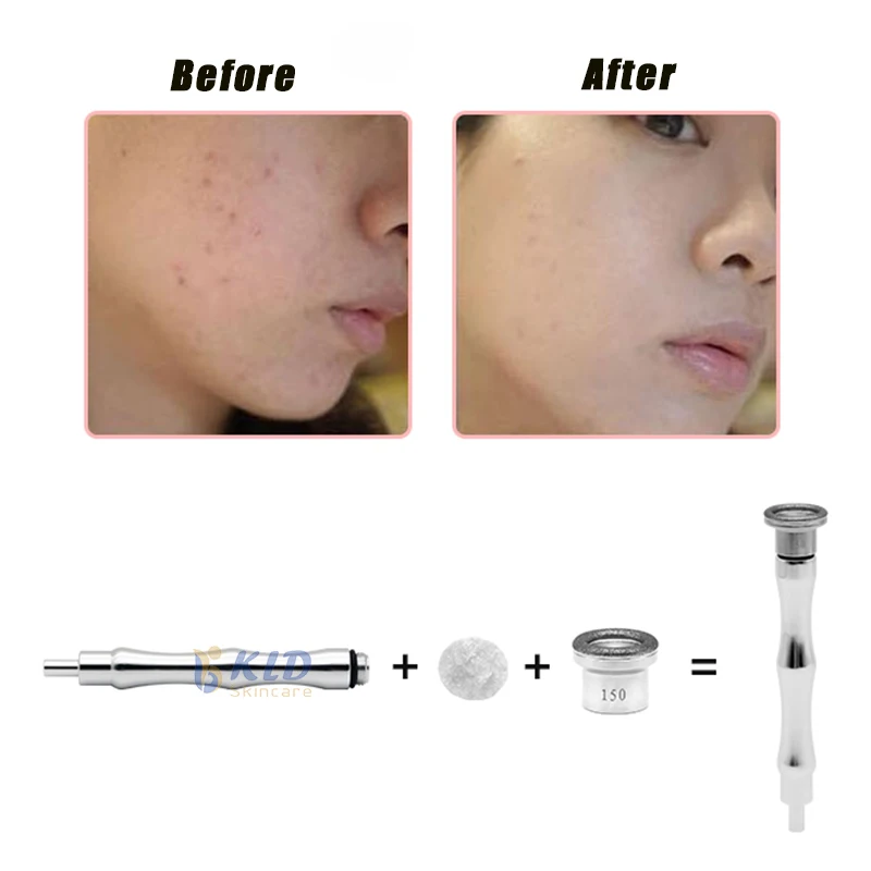 vacuum suction blackhead removal dremel diamond tip peel microdermabrasion machine/Facial Cleanser Skin Rejuvenation Machine