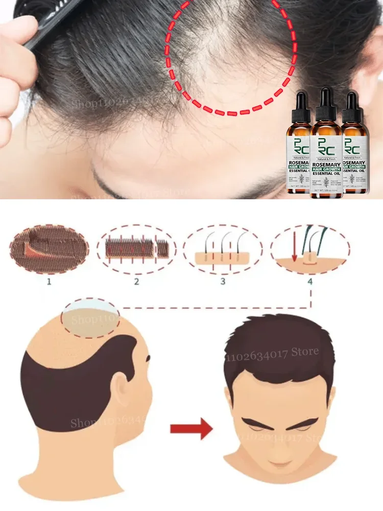 

Accelerate Hair Growth: Your New Hair Solution