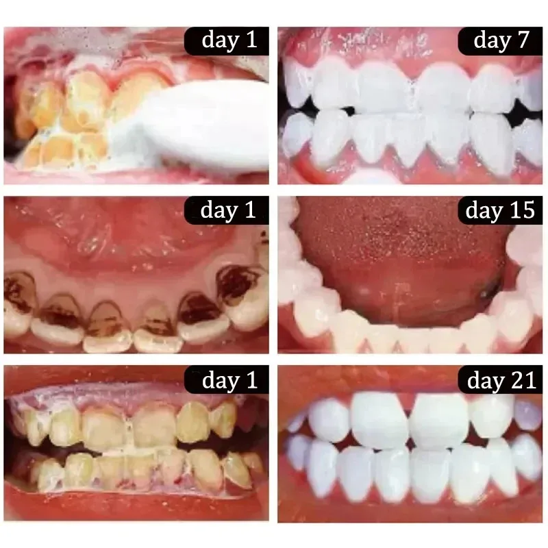 Зубная паста для отбеливания зубов на 5 дней, удаление пятен налета, порошок, глубокая очистка, гигиена полости рта, свежее дыхание, осветляющий уход за зубами, 50 г