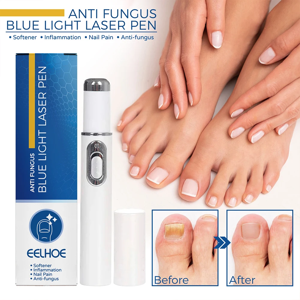 قلم إصلاح جل الأظافر الفطري ، مضاد للفطريات ، الضوء الأزرق ، فطار الأظافر ، بدون ألم ، مصل إزالة محمول ، منتجات إصلاح القدم ، ساخن #1