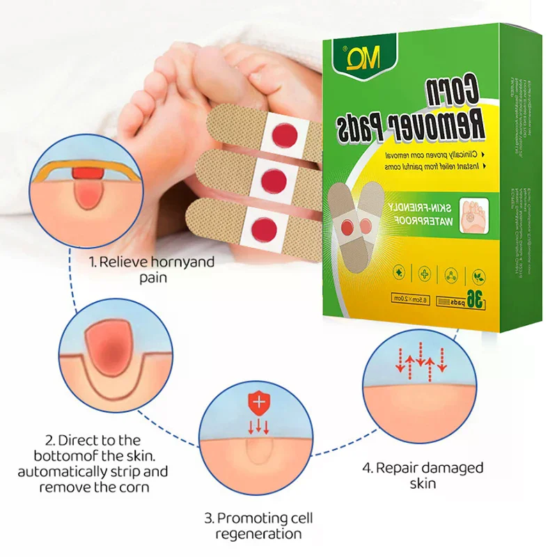 36PCS Foot Care Sticker  Patch Corn Removal Pads Curative Patches Calluses Remove Callosity Detox Summer Foot Care Tools