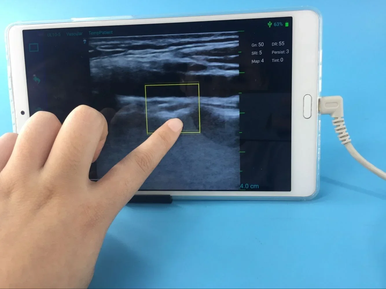 Portable 7.5Mhz Usb… - image