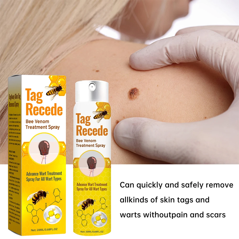 Pele indolor Tag Remoção Spray, Mole Wart Freckle Remover Equipamento, Micro Skin Tag Treatment Tool, Fácil de limpar, Ferramenta de cuidados com a pele