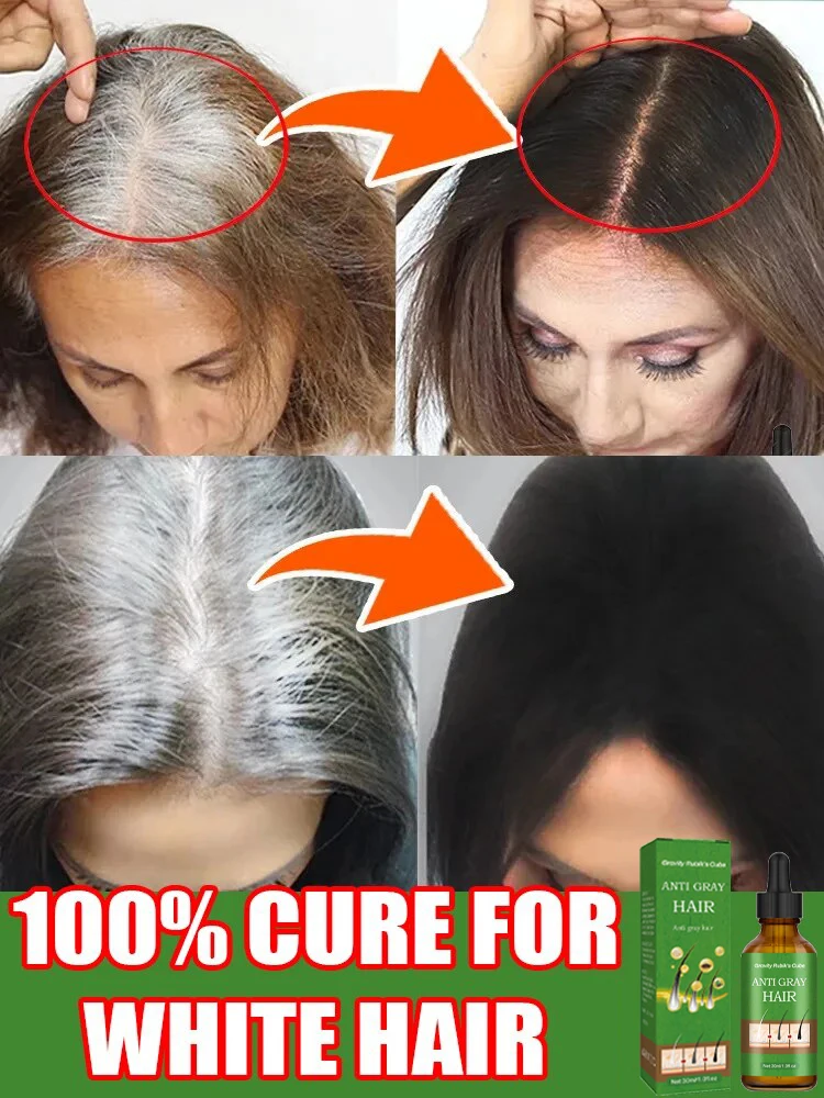 Suero Natural Anti gris para el cabello, reparación de cabello blanco y oscurecimiento, remedio nutritivo para el cuidado del