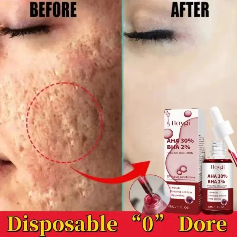 

Pore Shrinking Face Serum Remove Blackheads Oil Control Exfoliation Moisturizing Tightening Pores Firming Skin Care Products