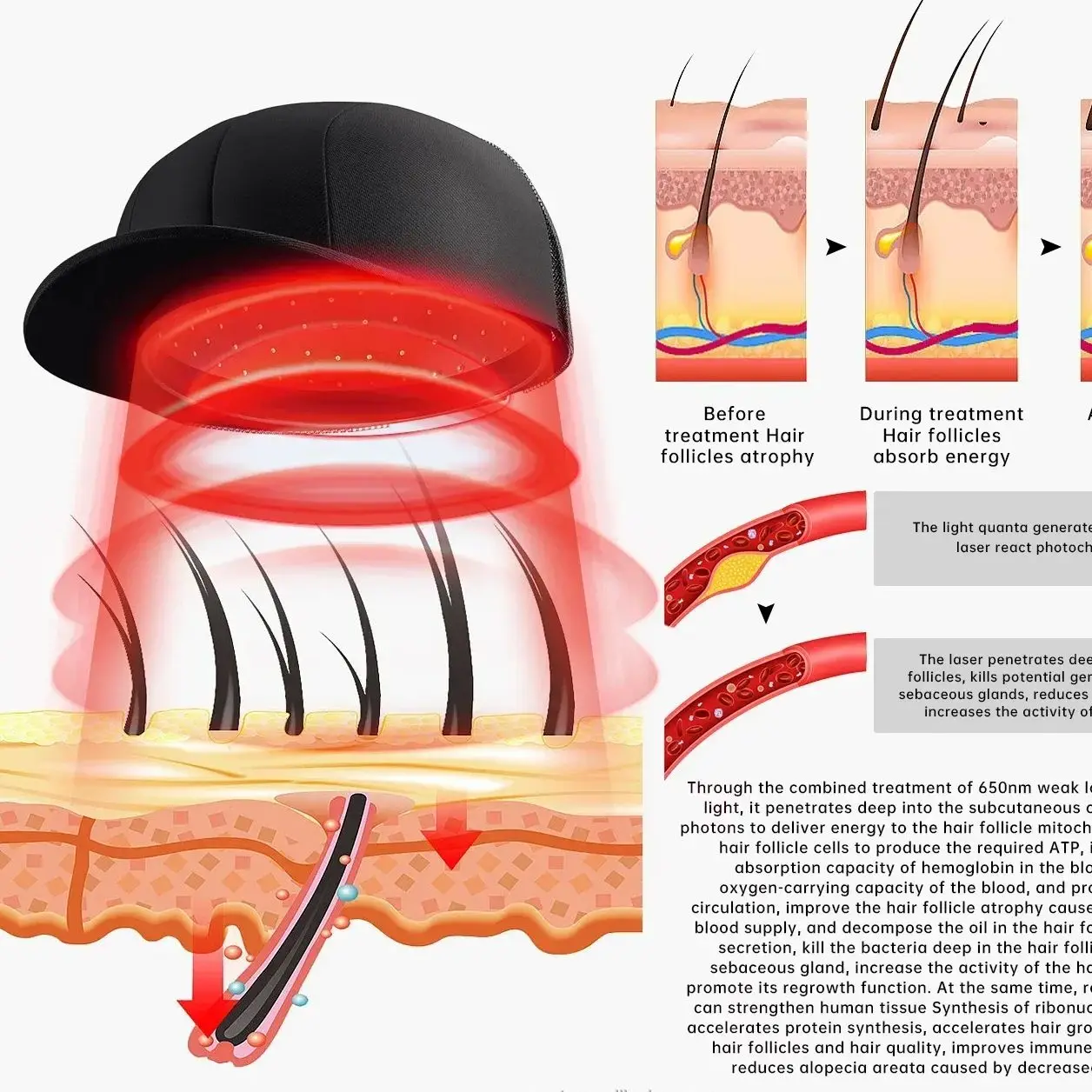 

Best Selling Red Light Cap for Hair Loss – Portable & Painless Hair Growth Stimulator – Clinically Proven for Men/Women