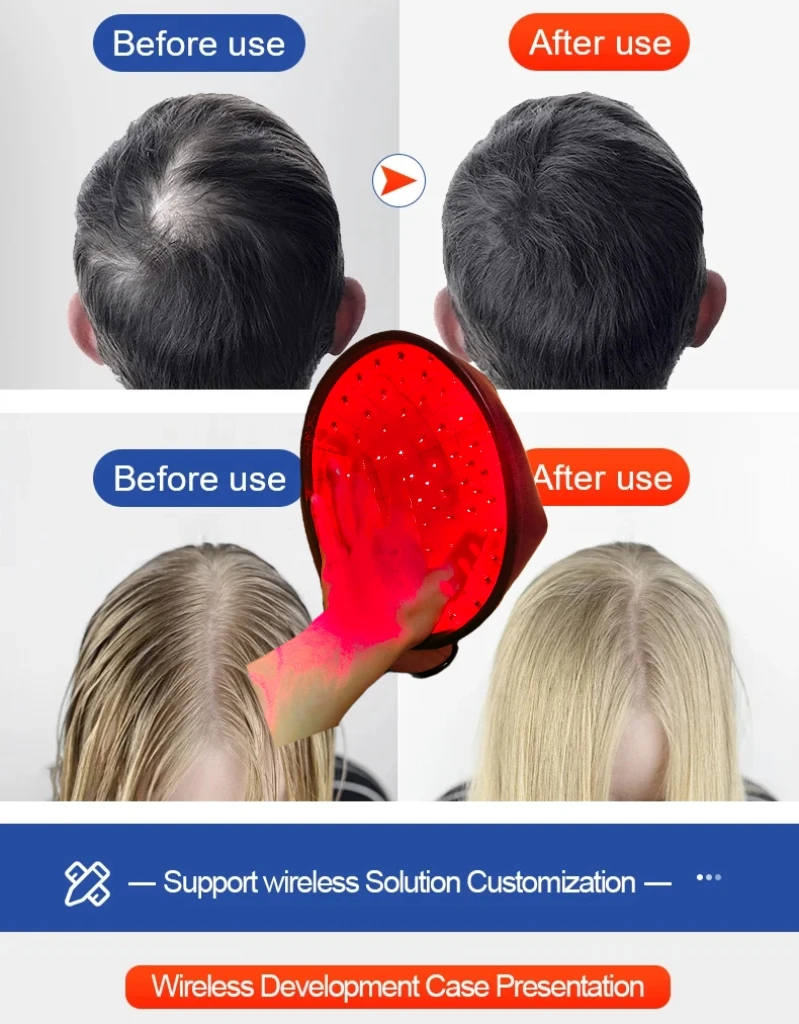 

Лазерная шапка для быстрого роста волос - терапевтическая шапка с красным светом и LLLT для восстановления кожи головы и волос