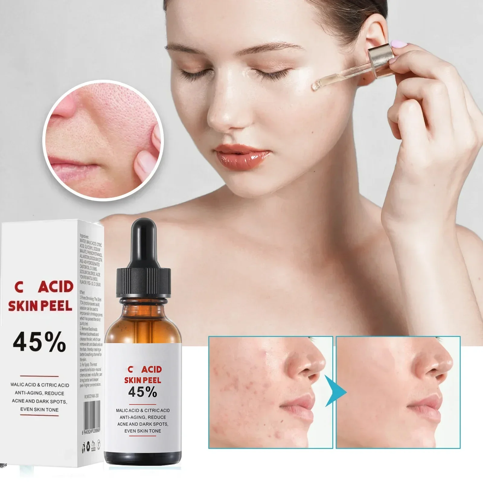 Gele Peeling Olie Bleken Donkere Huidvlekken Verwijderen Dode Huid Lichter Melanine Scrub Exfoliërende Witheid Hydrateren Gezichtsverzorging