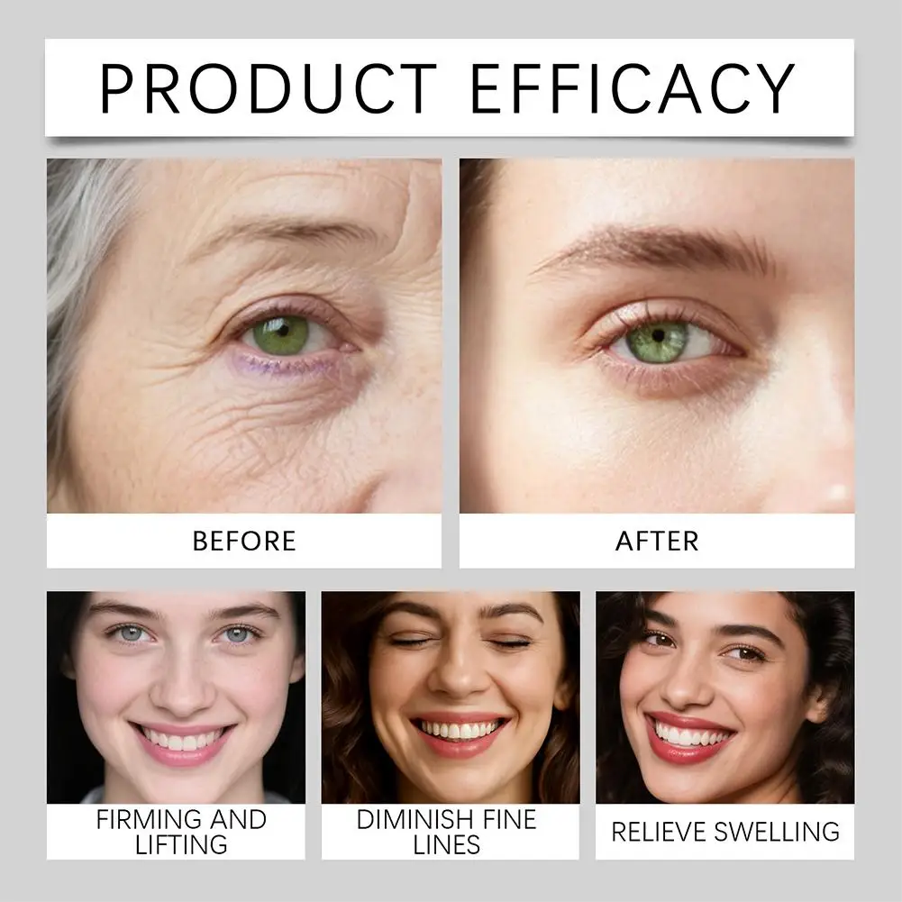 

Eye Cream Dark Circles Eye Bags Remover Anti Wrinkle Firming Eye Cream Skin Care Products