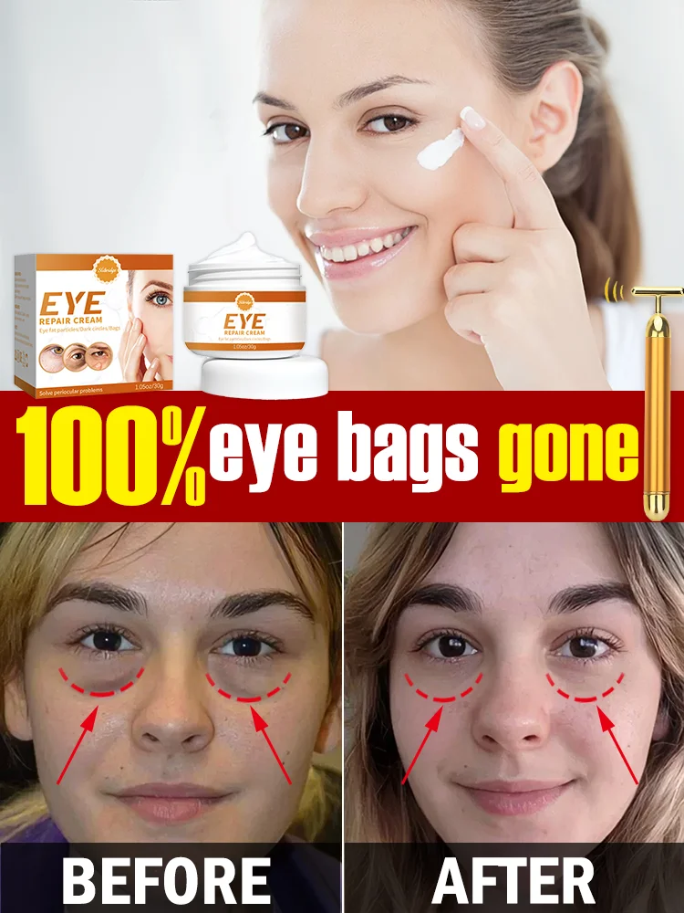 

aloe vera gel Solve all eyes problems