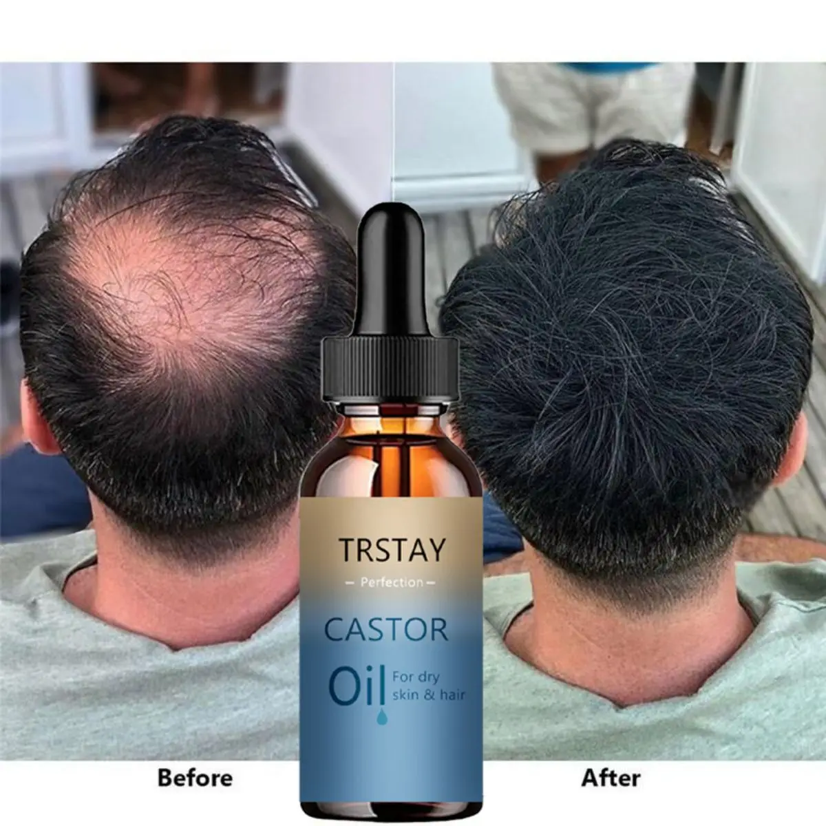 

TRSTAY New Arrivals Eyebrow Growth Serum Essential Oils Eyelash Essence Castor Oil Beard Growth Essence Rapid Growth