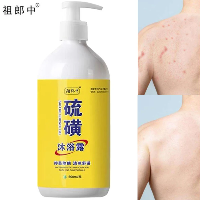 New Super 500ml Sulfur Liquid Soap Removing Mites Bath Gel Deep Cleaning Mites Removal Shower Gel Body Cleaning Health Care