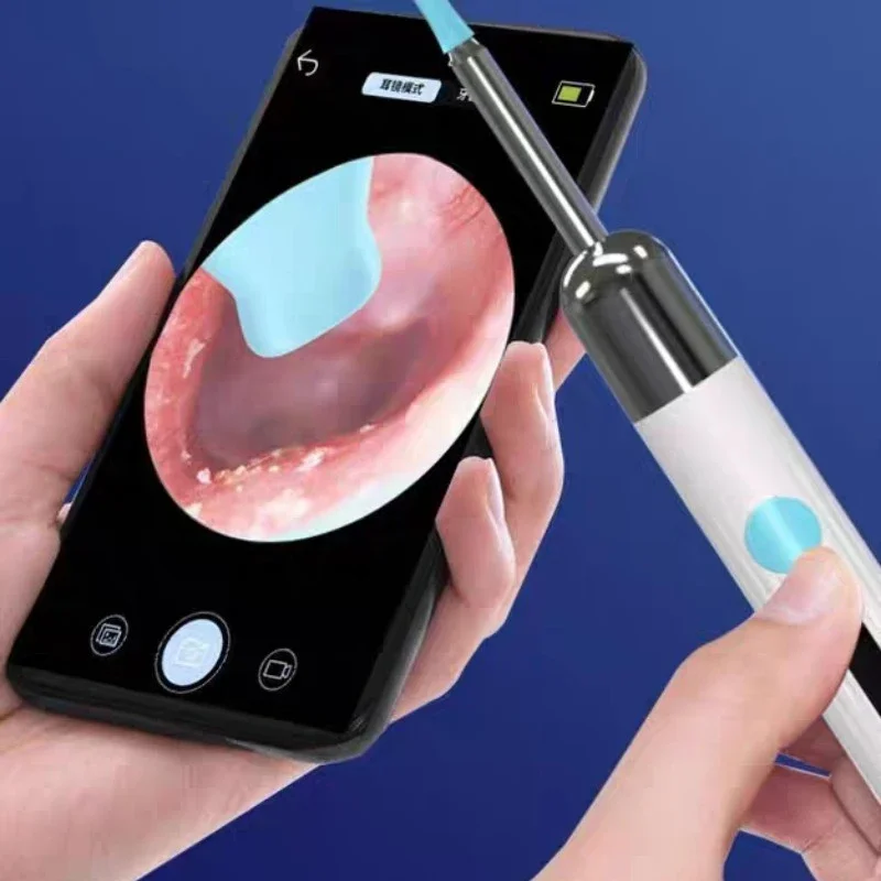 WiFi Endoskop 4,2 mm 1080P Ohr Picker Kamera für iOS/Android Ohr Reinigung Otoskop mit Ohrenschmalz Entfernung Werkzeug