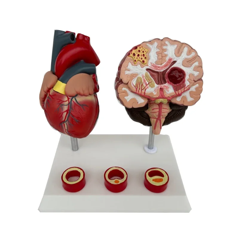 

Human brain anatomy, brain pathology, construction, cerebrovascular lesions, brain models, heart blood vessels 23x16x17cm