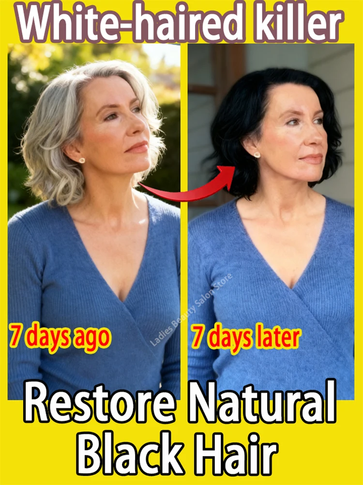 

This serum targets gray hair, nourishing and rejuvenating it. It's a unisex hair loss prevention and care product.