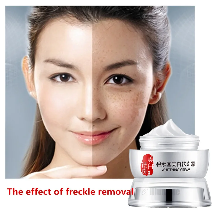 Freckle Removal Cream Chloasma Light Spot Water Desalination Freckles Removed Lighten