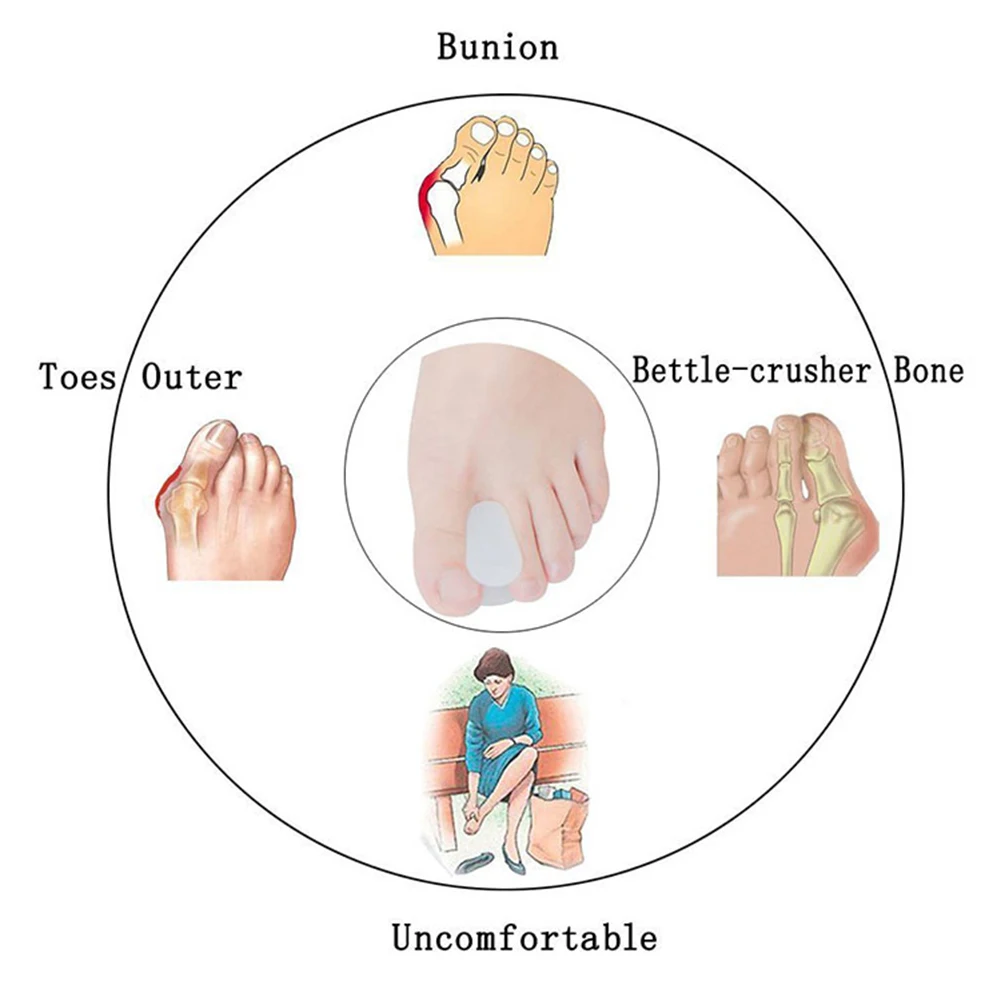 1 paio di regolatori ortopedici separatore dell'alluce dell'alluce distanziatore del dito dell'alluce correttore dell'alluce valgo regolatore cura dei piedi