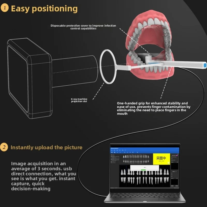

Dental X RAY Sensor Oral Digital XLight Sensor High Definition Xray Camera Imaging and Video System For Child and Adult