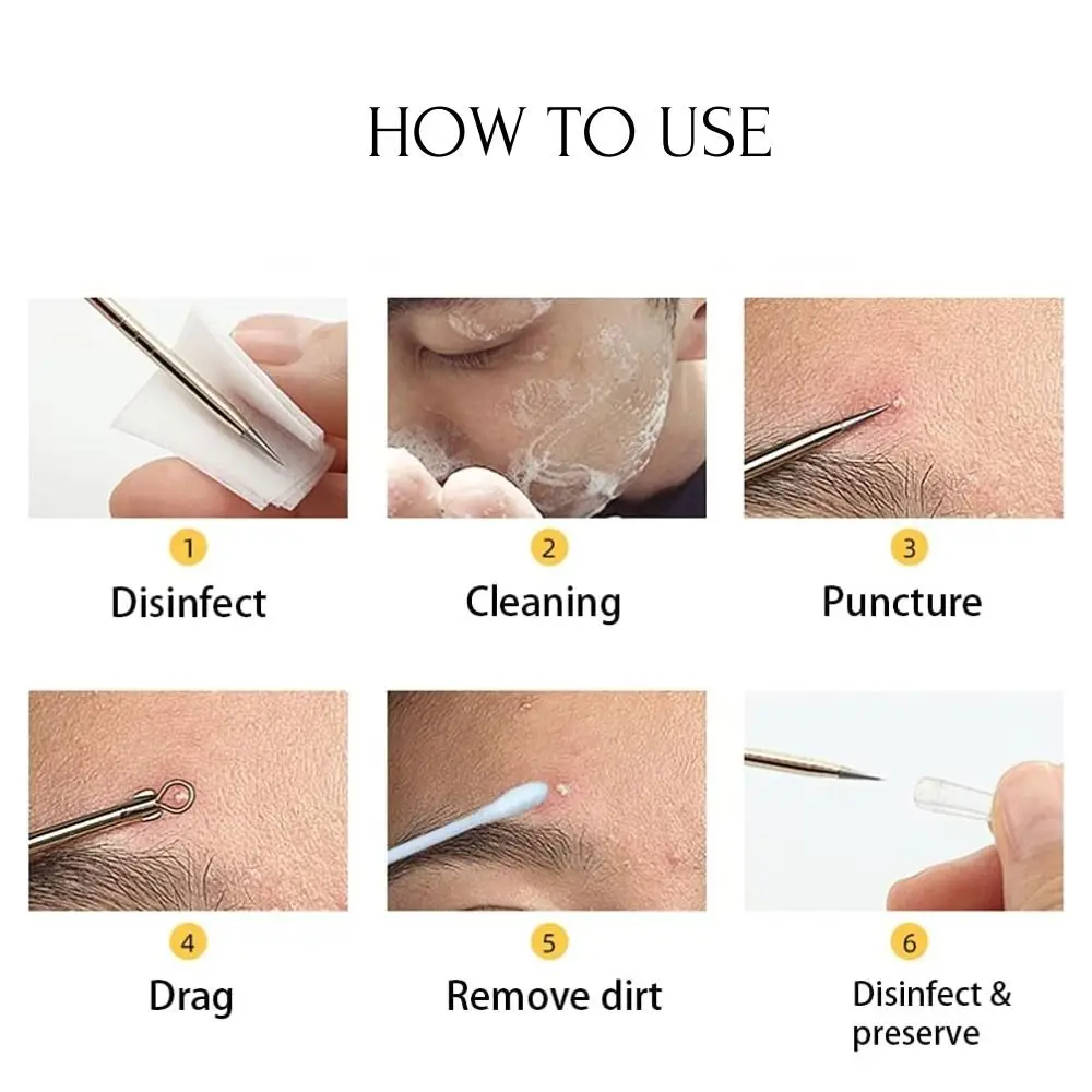 Pince à épiler pour enlever les boutons, grattage et fermeture des cellules, pour Salon de beauté, pincettes pour points noirs, outil pour la peau, nettoyeur en profondeur, aiguille pour l'acné, 4 pièces/ensemble